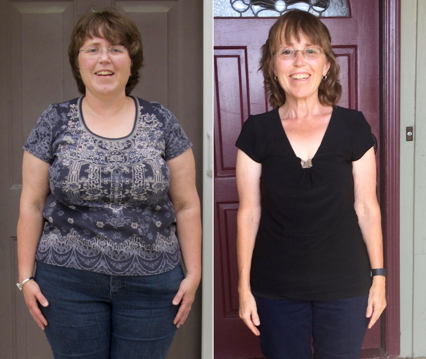 Изменения после 45. Похудение до и после. Похудевшая женщина. Похудение до и после фото. Результаты похудения.