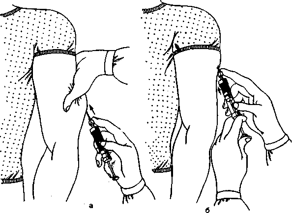 Колоть окончание. Инъекция в плечо внутримышечно. Инъекции гепарина подкожно алгоритм. Техника подкожной инъекции в плечо. Внутрикожная инъекция в плечо.