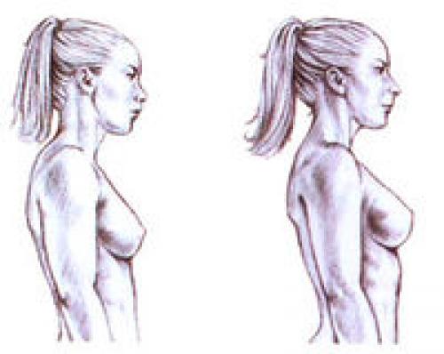 Упражнения для плечевого пояса для женщин. Совет